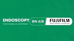 Endoscopy On Air - FujiFilm. Live steaming event 24.11.20